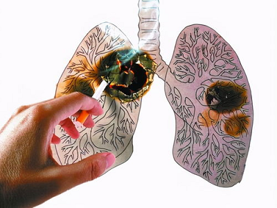 重庆市哪家中医馆治疗肺癌有效?